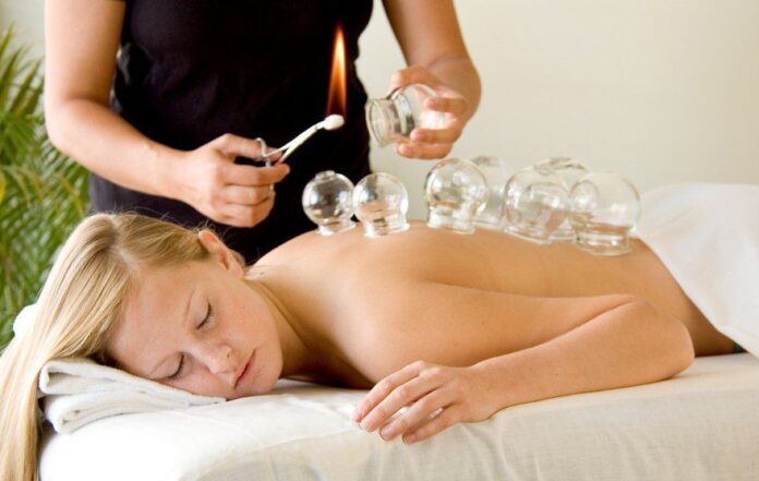 cupping therapy melbourne, cupping treatment melbourne, dry needling melbourne, dry needling physio melbourne