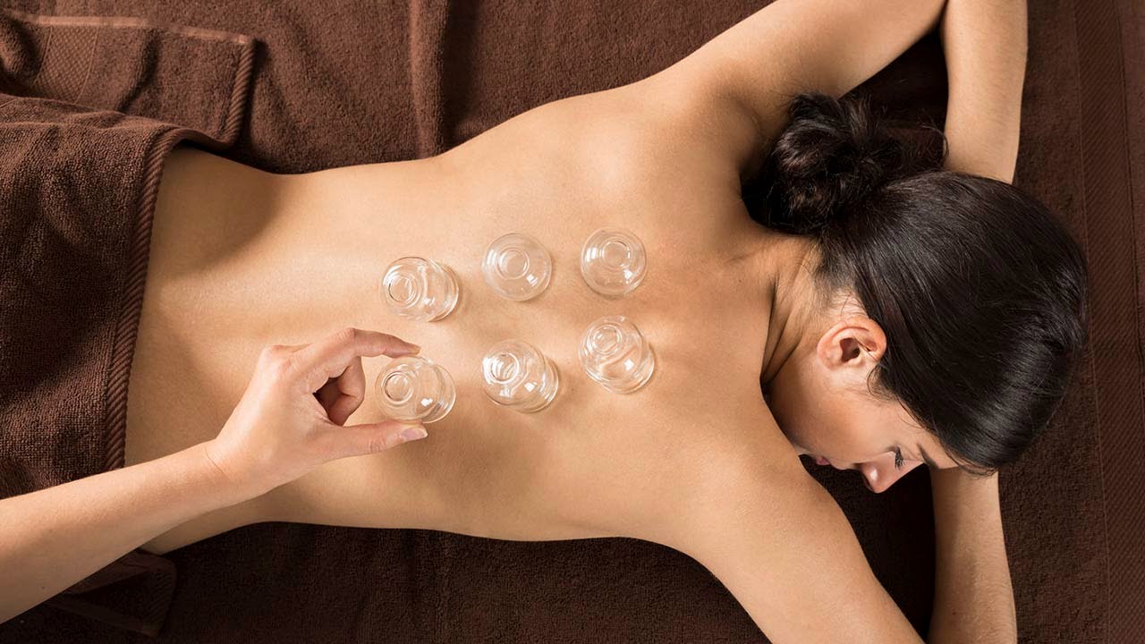 Cupping therapy Melbourne